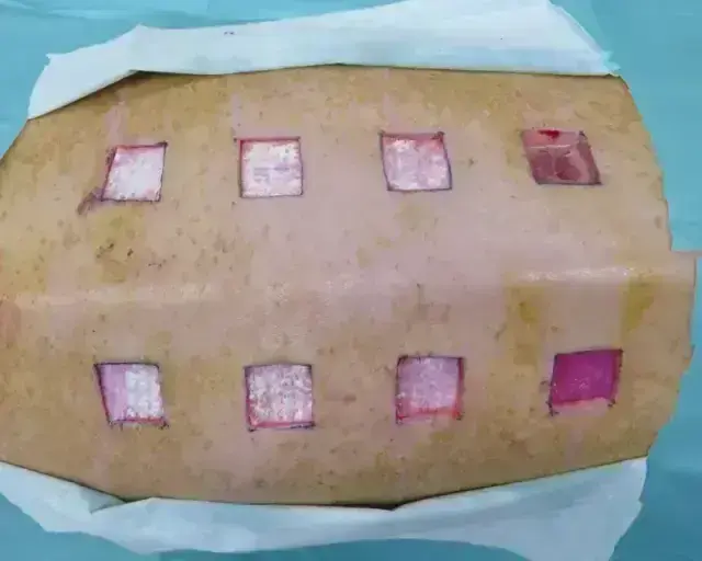 Skin/Wound Models