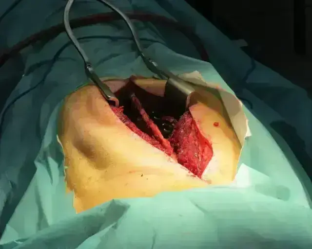 Spine/Orthopedic Models
