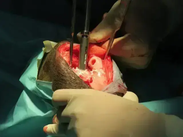 Stem Cell/Regenerative Models